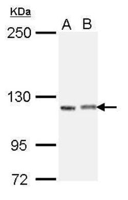 Invitrogen IGSF3 Isoform 2 Polyclonal Antibody 100 &mu;L | Buy Online | Invitrogen&trade; | Fisher Scientific