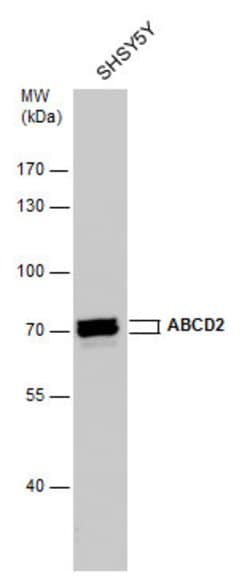 Invitrogen ABCD2 Polyclonal Antibody 100 &mu;L; Unconjugated:Antibodies,