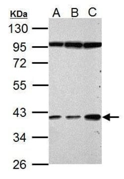 Invitrogen Haptoglobin Polyclonal Antibody 100 &mu;L; Unconjugated:Antibodies,