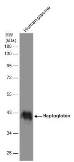 Invitrogen Haptoglobin Polyclonal Antibody 100 &mu;L; Unconjugated:Antibodies,