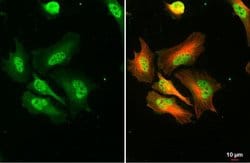 Invitrogen RPA2 Polyclonal Antibody 100 &mu;L; Unconjugated:Antibodies,