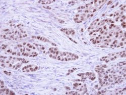 Invitrogen RPA2 Polyclonal Antibody 100 &mu;L; Unconjugated:Antibodies,
