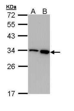 Invitrogen RPA2 Polyclonal Antibody 100 &mu;L; Unconjugated:Antibodies,