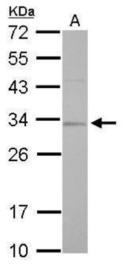 Invitrogen RPA2 Polyclonal Antibody 100 &mu;L; Unconjugated:Antibodies,