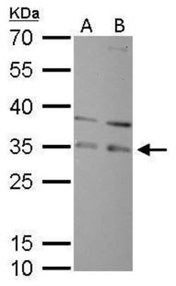 Invitrogen RPA2 Polyclonal Antibody 100 &mu;L; Unconjugated:Antibodies,