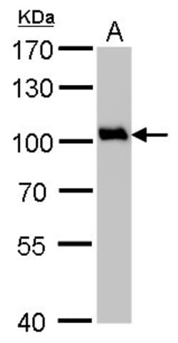 Invitrogen VCP Polyclonal Antibody 100 &mu;L; Unconjugated:Antibodies,