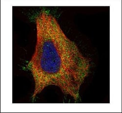 Invitrogen GAD65 Polyclonal Antibody 100 &mu;L | Buy Online | Invitrogen&trade; | Fisher Scientific