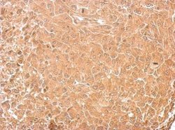 Invitrogen GAD65 Polyclonal Antibody 100 &mu;L | Buy Online | Invitrogen&trade; | Fisher Scientific