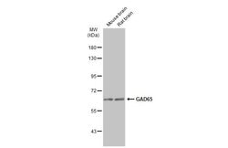 Invitrogen GAD65 Polyclonal Antibody 100 &mu;L | Buy Online | Invitrogen&trade; | Fisher Scientific
