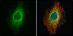 Invitrogen ROCK1 Polyclonal Antibody 100 &mu;L; Unconjugated:Antibodies,