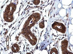 Invitrogen ROCK1 Polyclonal Antibody 100 &mu;L; Unconjugated:Antibodies,