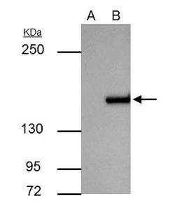 Invitrogen ROCK1 Polyclonal Antibody 100 &mu;L; Unconjugated:Antibodies,