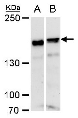 Invitrogen ROCK1 Polyclonal Antibody 100 &mu;L; Unconjugated:Antibodies,