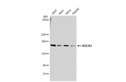 Invitrogen ROCK1 Polyclonal Antibody 100 &mu;L; Unconjugated:Antibodies,
