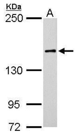 Invitrogen ROCK1 Polyclonal Antibody 100 &mu;L; Unconjugated:Antibodies,