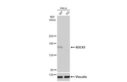 Invitrogen ROCK1 Polyclonal Antibody 100 &mu;L; Unconjugated:Antibodies,