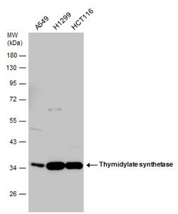 Invitrogen Thymidylate Synthase Polyclonal Antibody 100 &mu;L; Unconjugated:Antibodies,