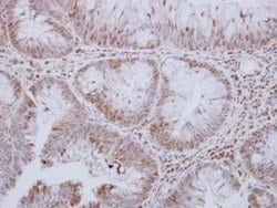 Invitrogen MST3 Polyclonal Antibody 100 &mu;L; Unconjugated:Antibodies,