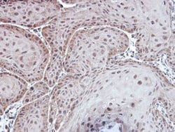 Invitrogen Aspartoacylase Polyclonal Antibody 100 &mu;L; Unconjugated:Antibodies,
