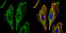 Invitrogen Aspartoacylase Polyclonal Antibody 100 &mu;L; Unconjugated:Antibodies,