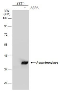 Invitrogen Aspartoacylase Polyclonal Antibody 100 &mu;L; Unconjugated:Antibodies,