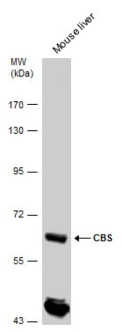 Invitrogen CBS Polyclonal Antibody 100 &mu;L; Unconjugated:Antibodies,