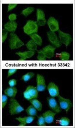 Invitrogen CLN2 Polyclonal Antibody 100 &mu;L; Unconjugated:Antibodies,