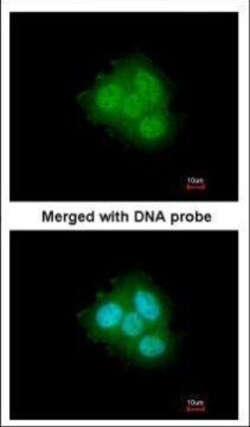 Invitrogen FKBP4 Polyclonal Antibody 100 &mu;L; Unconjugated:Anticuerpos