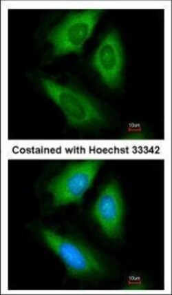 Invitrogen HPRT1 Polyclonal Antibody 100 &mu;L; Unconjugated:Antibodies,
