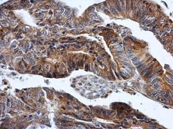 Invitrogen HPRT1 Polyclonal Antibody 100 &mu;L; Unconjugated:Antibodies,