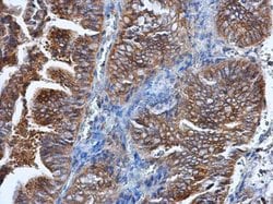 Invitrogen HPRT1 Polyclonal Antibody 100 &mu;L; Unconjugated:Antibodies,