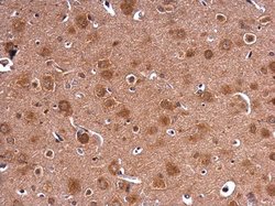 Invitrogen HPRT1 Polyclonal Antibody 100 &mu;L; Unconjugated:Antibodies,