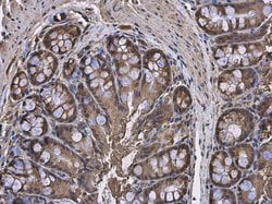 Invitrogen HPRT1 Polyclonal Antibody 100 &mu;L; Unconjugated:Antibodies,