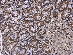 Invitrogen HPRT1 Polyclonal Antibody 100 &mu;L; Unconjugated:Antibodies,