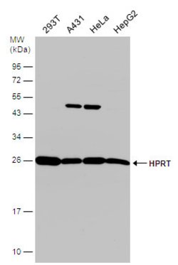 Invitrogen HPRT1 Polyclonal Antibody 100 &mu;L; Unconjugated:Antibodies,