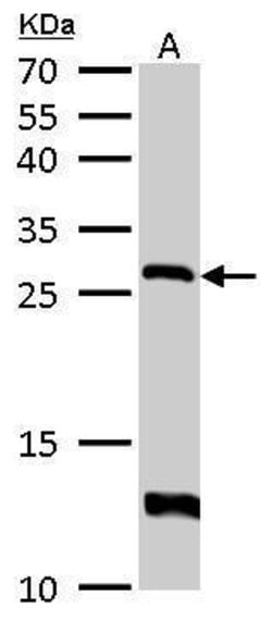 Invitrogen HPRT1 Polyclonal Antibody 100 &mu;L; Unconjugated:Antibodies,