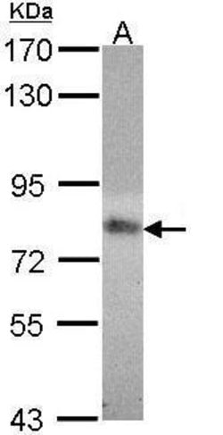 Invitrogen MTHFR Polyclonal Antibody 100 μL; Unconjugated:Antibodies,