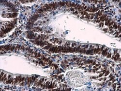 Invitrogen NuMA Polyclonal Antibody 100 &mu;L; Unconjugated:Anticuerpos