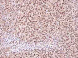 Invitrogen PSMA6 Polyclonal Antibody 100 &mu;L | Buy Online | Invitrogen&trade; | Fisher Scientific