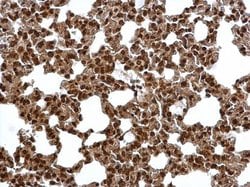 Invitrogen PSMA6 Polyclonal Antibody 100 &mu;L | Buy Online | Invitrogen&trade; | Fisher Scientific