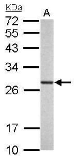 Invitrogen PSMA6 Polyclonal Antibody 100 &mu;L | Buy Online | Invitrogen&trade; | Fisher Scientific