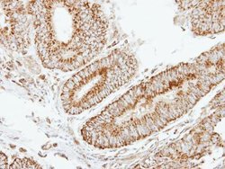 Invitrogen eIF2b beta Polyclonal Antibody 100 &mu;L; Unconjugated:Antibodies,