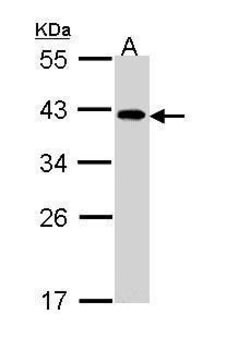 Invitrogen eIF2b beta Polyclonal Antibody 100 &mu;L; Unconjugated:Antibodies,