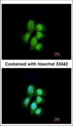 Invitrogen MVP Polyclonal Antibody 100 &mu;L | Buy Online | Invitrogen&trade; | Fisher Scientific