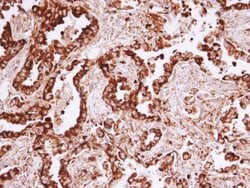 Invitrogen MVP Polyclonal Antibody 100 &mu;L; Unconjugated:Antibodies,