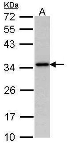 NAT1 Polyclonal Antibody, Invitrogen&trade; 100 &mu;L; Unconjugated 