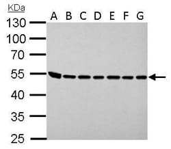 Invitrogen ASL Polyclonal Antibody 100 &mu;L; Unconjugated:Antibodies,