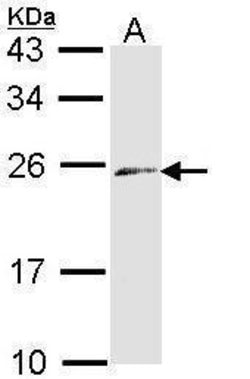 Invitrogen Endothelin 3 Polyclonal Antibody 100 &mu;L; Unconjugated:Antibodies,