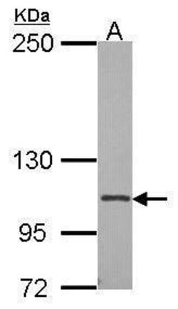 Invitrogen CD41 Polyclonal Antibody 100 μL; Unconjugated:Antibodies,