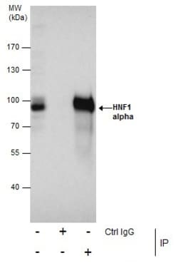 Invitrogen HNF1A Polyclonal Antibody 100 &mu;L | Buy Online | Invitrogen&trade; | Fisher Scientific